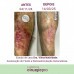 FLUIDO POS-OPERATORIO COM EXOSSOMAS 80ML LA VERTUAN