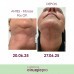 FLUIDO POS-OPERATORIO COM EXOSSOMAS 80ML LA VERTUAN