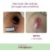 FLUIDO POS-OPERATORIO COM EXOSSOMAS 80ML LA VERTUAN